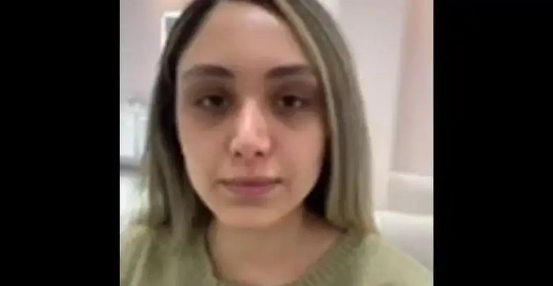 تصویر قبل از میکاپ و آرایش صورت خانم با پوست طبیعی و بدون گریم جهت نمایش تغییرات قبل و بعد در سالن زیبایی و آرایشی