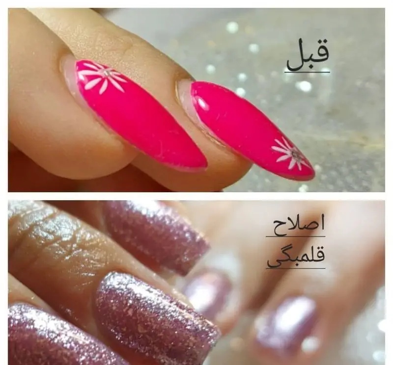 نمونه مقایسه قبل و بعد اصلاح قلمبگی کاشت ناخن و ترمیم آن با لاک اکلیلی صورتی براق در سالن خدمات تخصصی ناخن حدیث