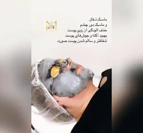 مراحل انجام ماسک ذغال فعال و ماسک دور چشم برای پاکسازی عمیق پوست، رفع جوش و آکنه و شفاف سازی پوست صورت در کلینیک زیبایی