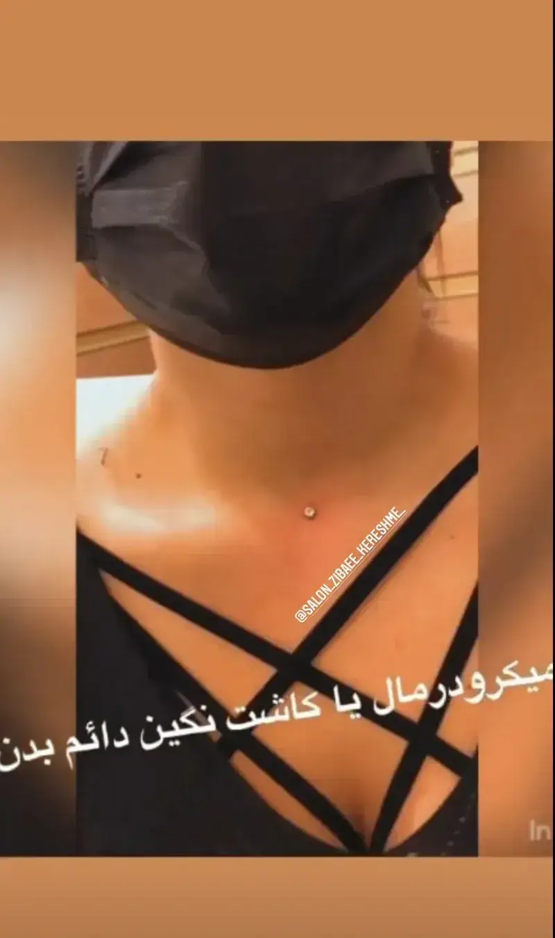 کاشت نگین دائم بدن یا میکرودرمال روی پوست ترقوه با استفاده از نگین‌های استریل و ضدحساسیت در سالن زیبایی کرشمه تهران