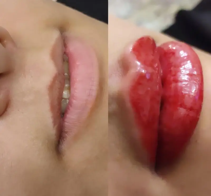 تصویر قبل و بعد شیدینگ لب و تاتو رژ لب دائم، تغییر رنگ و فرم لبها با تکنیک میکروپیگمنتیشن در مرکز تخصصی آرایش دائم