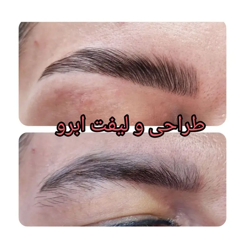 نمونه‌ای از خدمات تخصصی لیفت و طراحی ابرو در سالن زیبایی کیانا. قبل و بعد لیفت ابرو طبیعی و جذاب در مرکز اپیلاسیون و زیبایی کیانا.