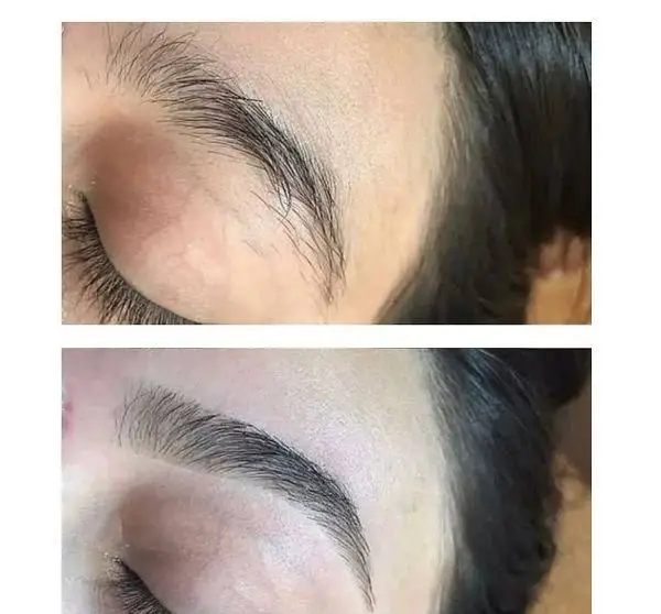 نمونه کار قبل و بعد لیفت و قرینه سازی ابرو در سالن زیبایی کیانا. ابروهای پرپشت و خوش‌فرم با خدمات حرفه‌ای ما.