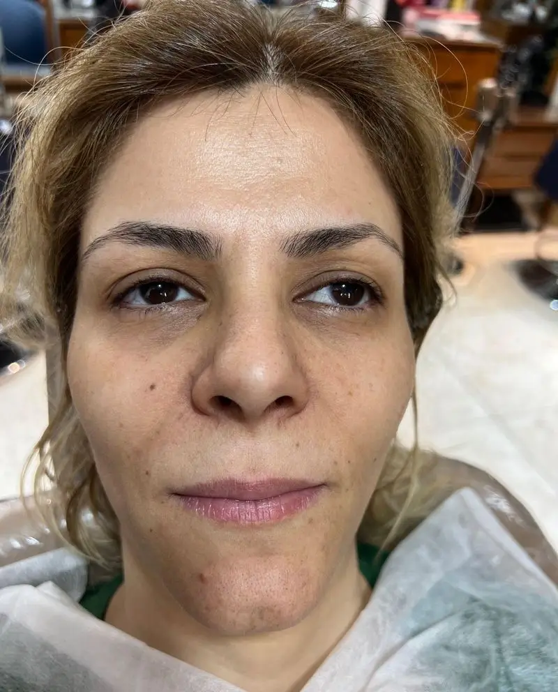 پرتره نزدیک از چهره مشتری سالن زیبایی و اپیلاسیون کیانا، پیش از شروع خدمات تخصصی مراقبت پوست و زیبایی.