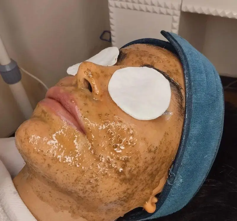 مراحل انجام فیشیال تخصصی پوست صورت با ماسک حبابی مغذی و پدهای پنبهای روی چشمها جهت جوانسازی و پاکسازی عمیق پوست