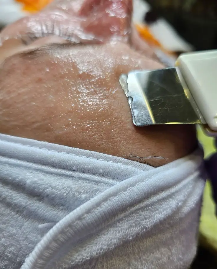 مراحل پاکسازی و لایه برداری عمیق پوست صورت با دستگاه اتوی صورت یا درما اف در کلینیک تخصصی پوست و فیشیال حرفهای