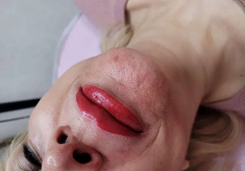 تصویر نزدیک از تاتو رژ لب دائم یا شیدینگ لب با رنگ قرمز جذاب و طبیعی جهت افزایش زیبایی و خوشرنگ شدن لبهای خانمها