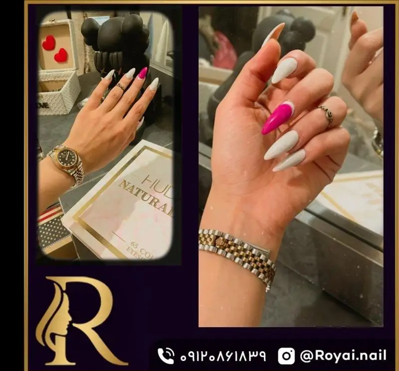 نمونه کاشت ناخن بلند و نوک تیز با لاک ژل سفید و تک ناخن صورتی درخشان به همراه ساعت مچی زنانه در سالن زیبایی مدیس