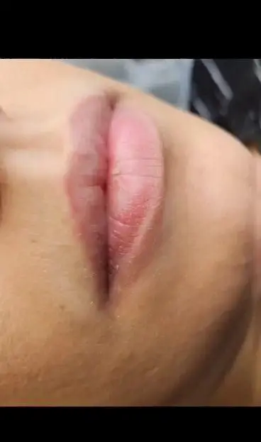 نمونه کار شیدینگ لب طبیعی و رژ لب دائم با رنگ صورتی ملایم جهت قرینه‌سازی و افزایش زیبایی لب‌ها در سالن تخصصی آرایش دائم