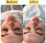 تصویر 4 - مرکز فیشیال تخصصی و پاکسازی صورت شبنم