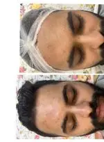 تصویر 3 - مرکز فیشیال تخصصی و پاکسازی صورت شبنم