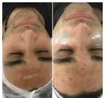 تصویر 2 - مرکز فیشیال تخصصی و پاکسازی صورت شبنم