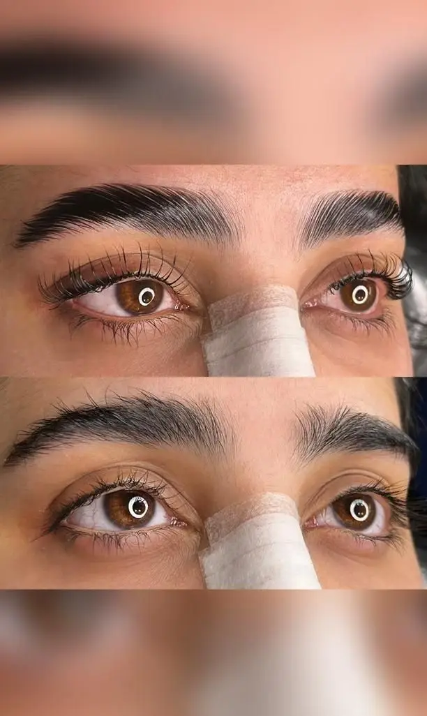 تصویر قبل و بعد لمینت ابرو و لیفت مژه در آرایشگاه زنانه آنا؛ زیبایی طبیعی چشم‌ها با مژه‌های بلند و ابروهای شانه شده.