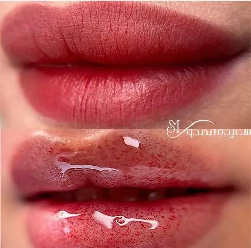 مراحل انجام شیدینگ لب و تاتو رژ لب دائم با پیگمنت‌های ارگانیک جهت خوش‌رنگ کردن و رفع تیرگی لب در مرکز سعیده مهدوی